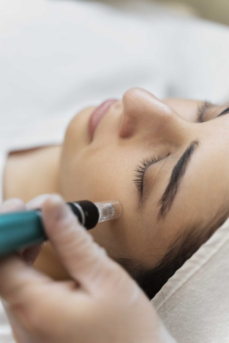 Profhilo Treatment 2 at KB Wellness Clinic