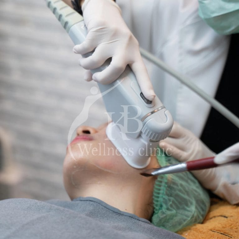 High Intensity Focused Ultrasound Hifu1 at KB Wellness Clinic