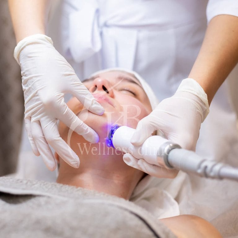 Laser Treatment1 at KB Wellness Clinic