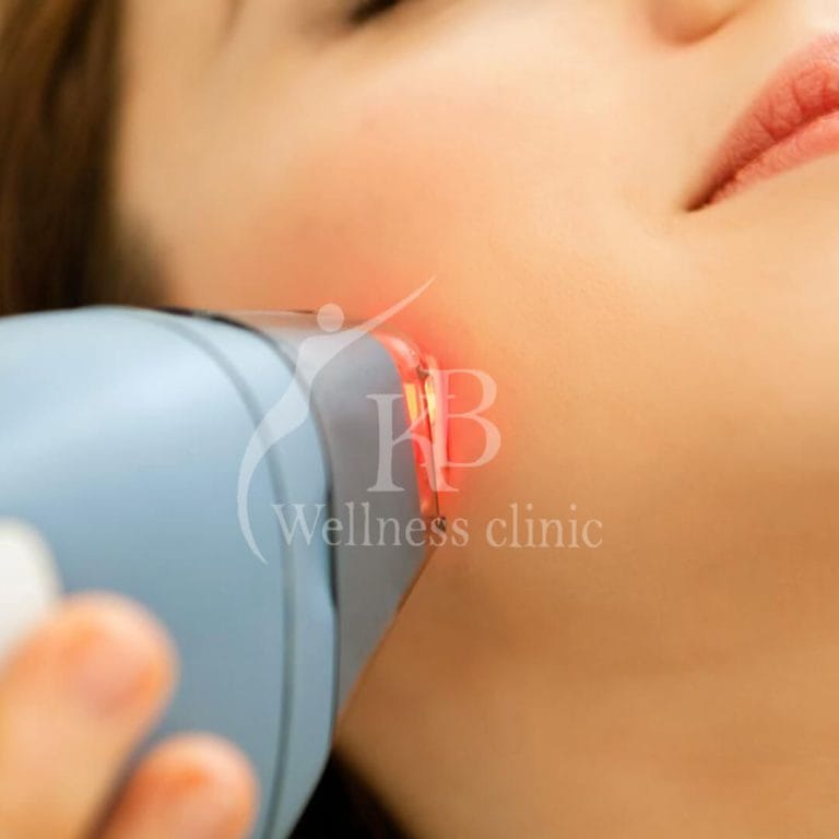 Laser Treatment2 at KB Wellness Clinic