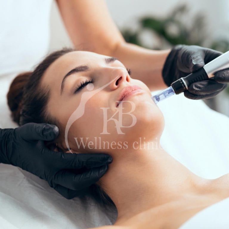 Mesotherapy2 at KB Wellness Clinic