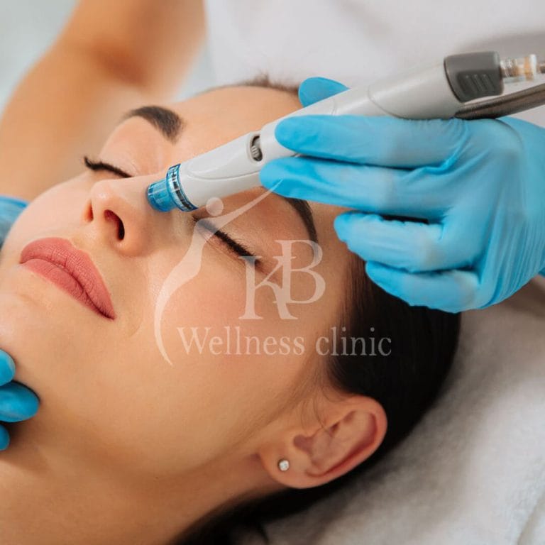 Skin Treatment1 at KB Wellness Clinic