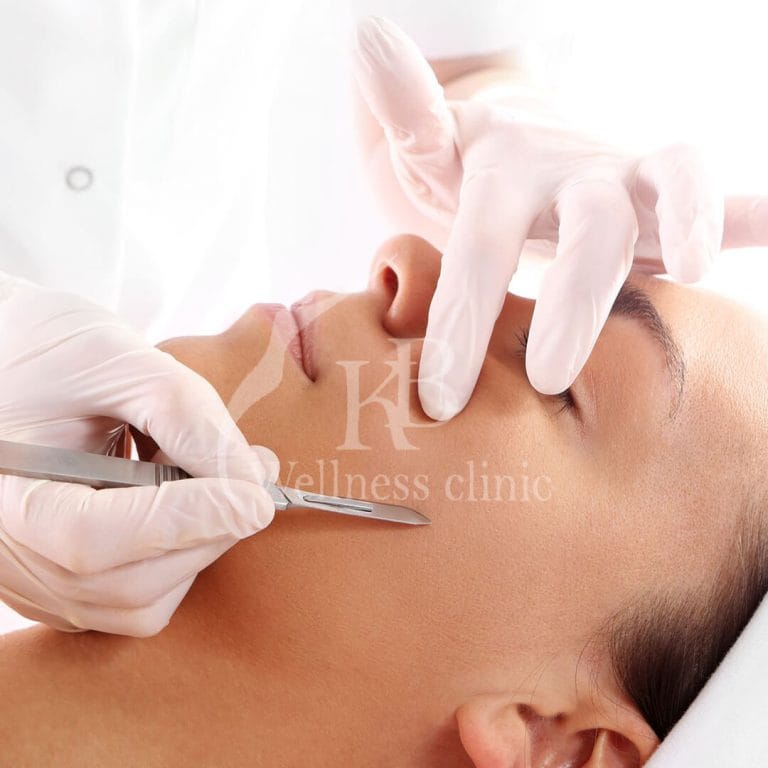 Skin Treatment2 at KB Wellness Clinic