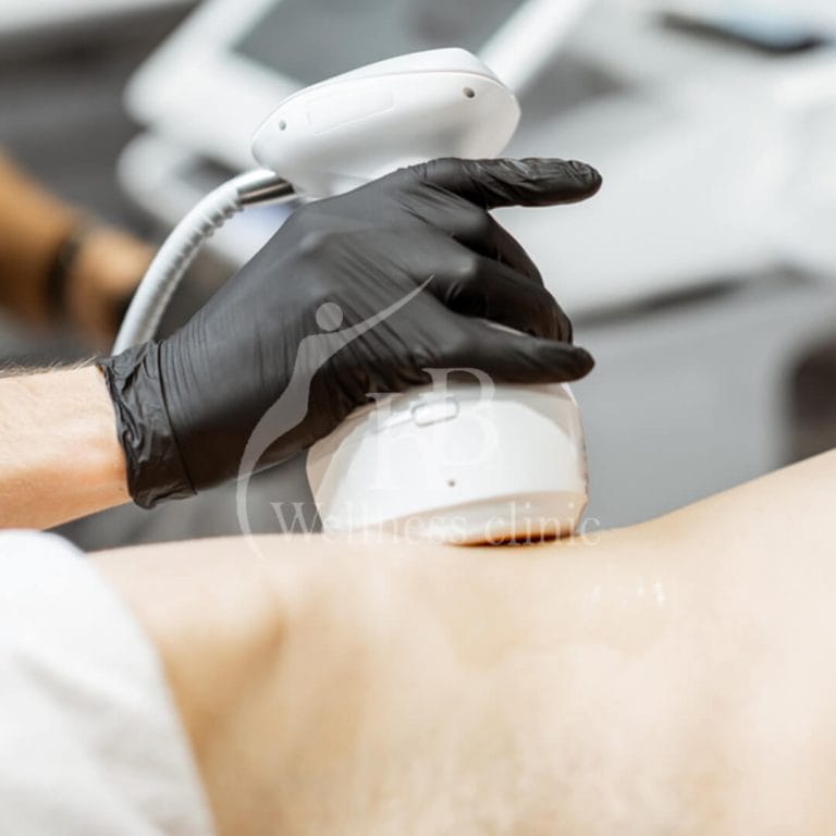 Ultrasonic Lipolysis1 at KB Wellness Clinic