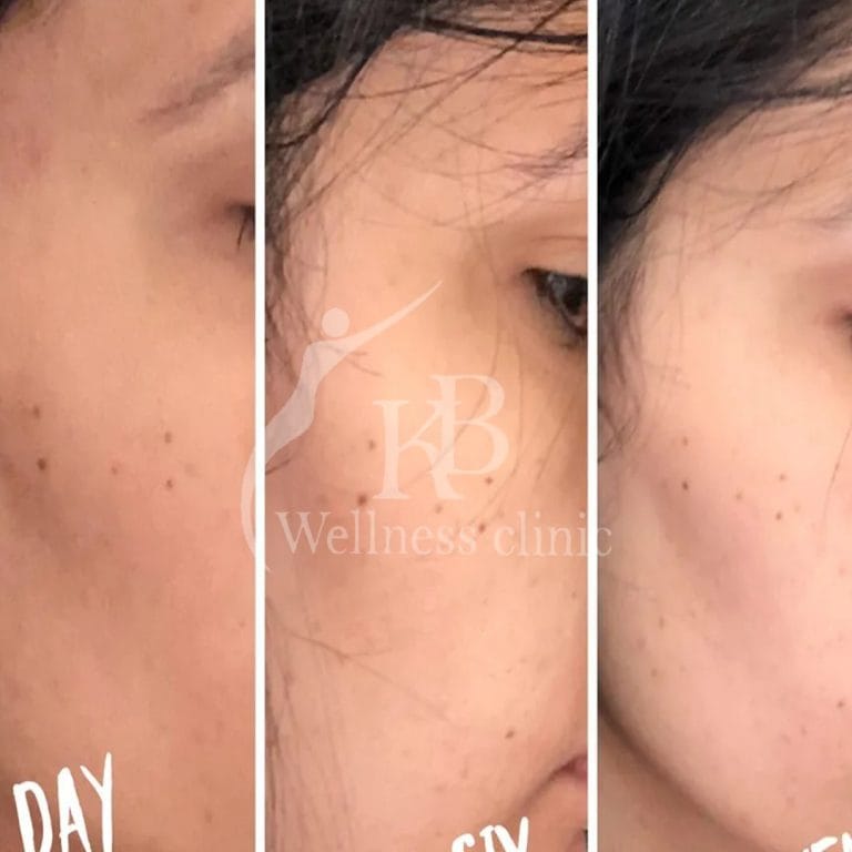 Whatsapp Image 2023 02 23 At 4 12 53 Pm at KB Wellness Clinic