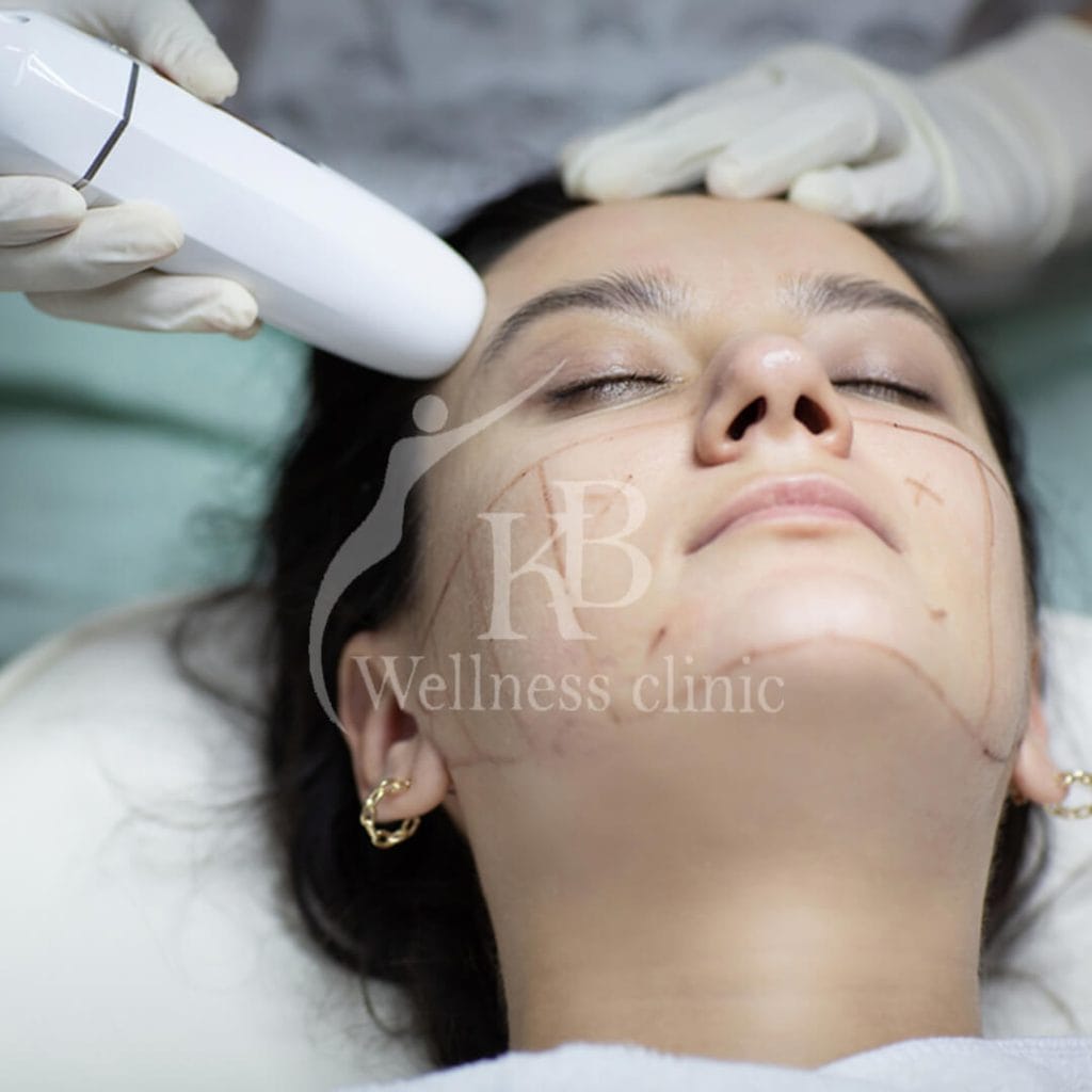 Advance Skin Treatment in Vile Parle East, HIFU skin tightening Mumbai